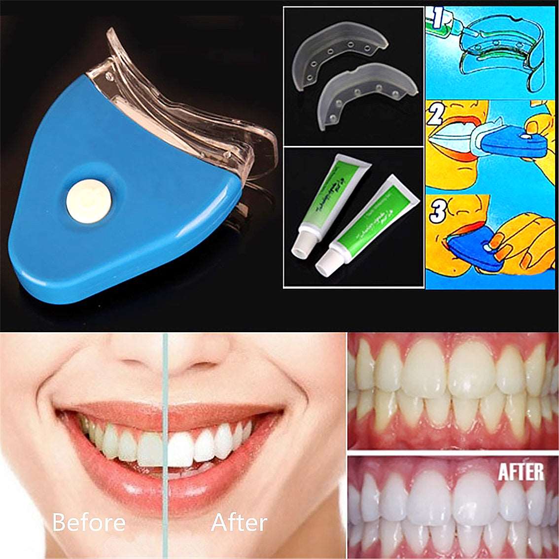 SparkleBright LED Dentalt Bleksystem